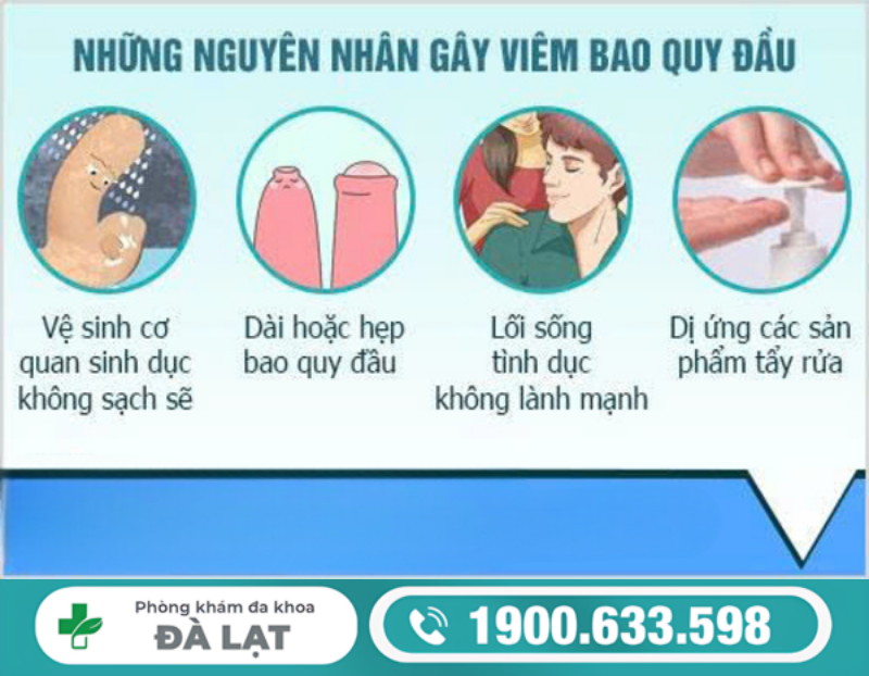 Hình ảnh minh họa